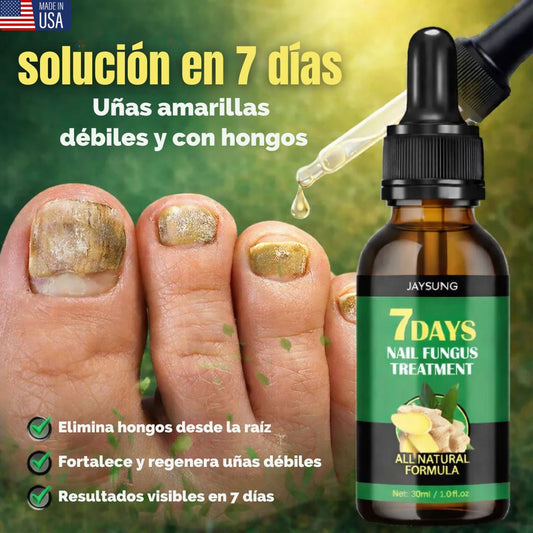 7 DaysNails®  Elimina hongos y fortalece tus uñas de pies y manos en 7 días