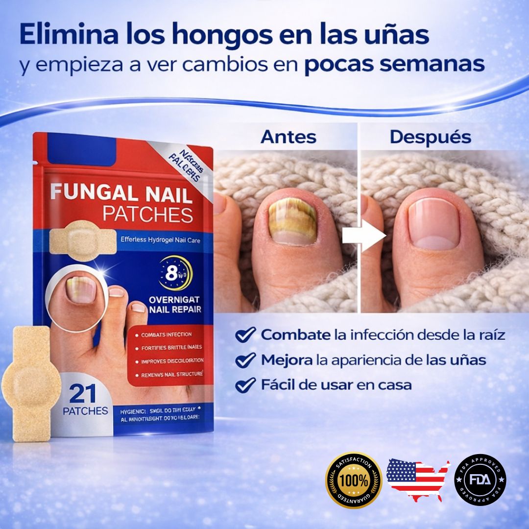 Reduce el aspecto amarillento y grueso de tus uñas desde casa, sin tratamientos agresivos