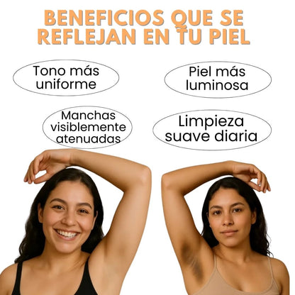 Jabón de Cúrcuma™ Tratamiento Despigmentante Diario