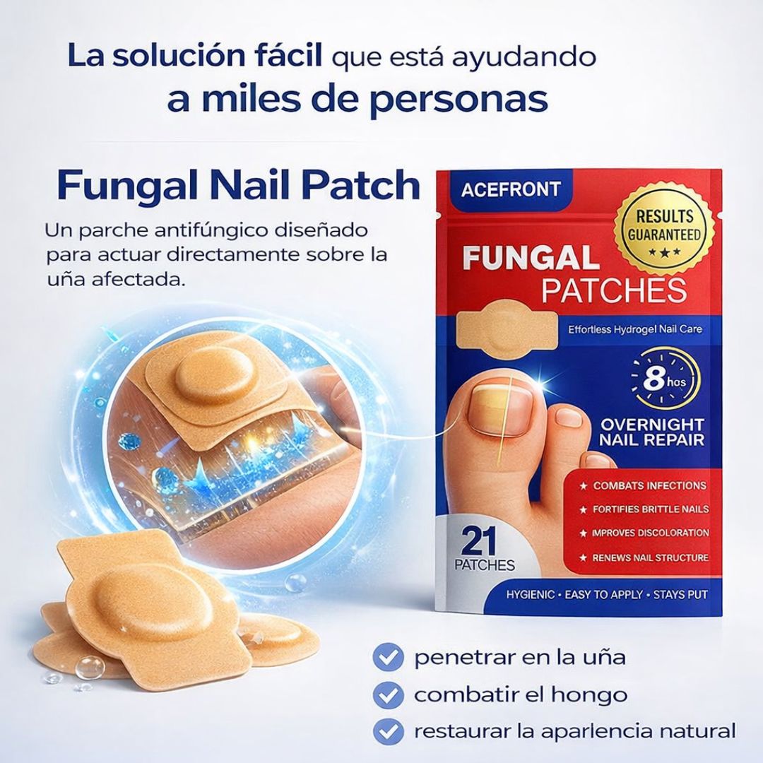 Reduce el aspecto amarillento y grueso de tus uñas desde casa, sin tratamientos agresivos