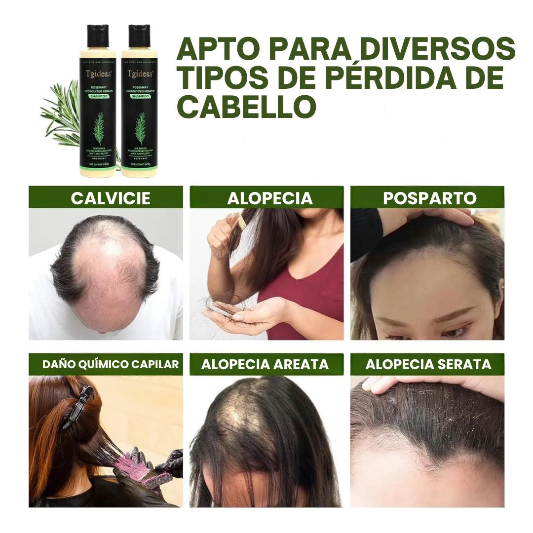 Tgideas Rosemary Shampoo Más volumen y menos caída desde las primeras semanas