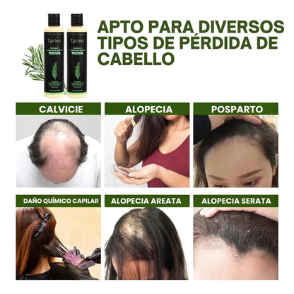Tgideas Rosemary Shampoo Más volumen y menos caída desde las primeras semanas