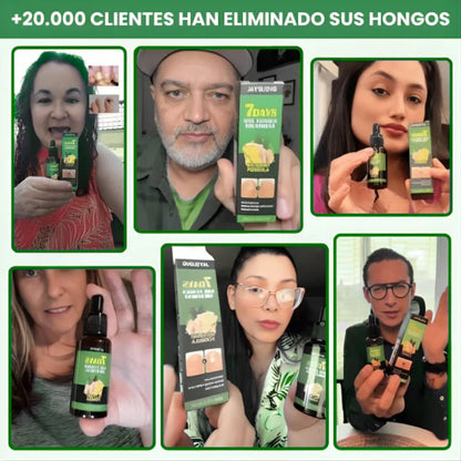 7 DaysNails®  Elimina hongos y fortalece tus uñas de pies y manos en 7 días