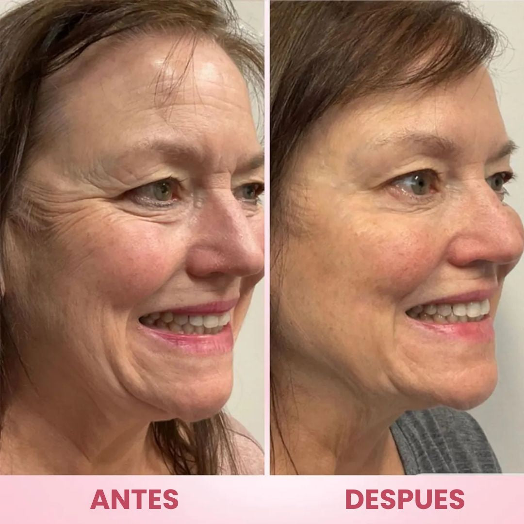 Balsamo Wrinkle Efecto piel coreana Anti-edad para lineas de expresion