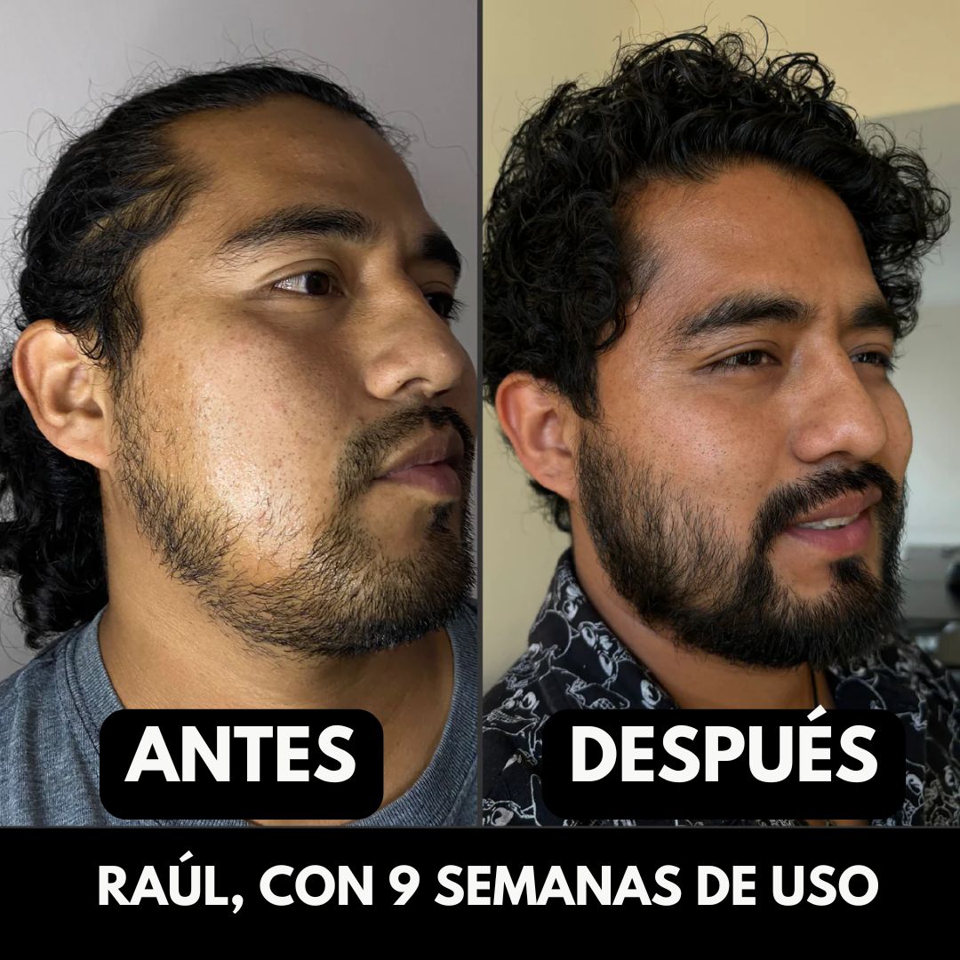 Apolo Consigue una Barba con Apariencia Más Densa, Uniforme y Masculina - 100ML