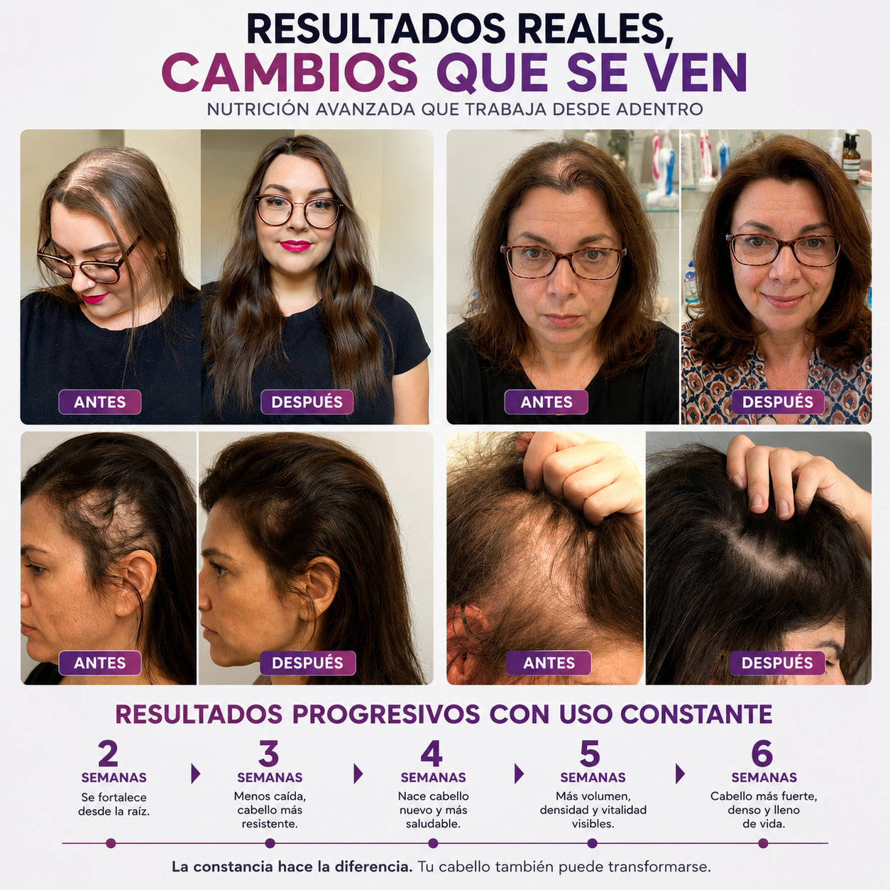 HairGrowth frena la caída y reactiva el crecimiento capilar desde la 1 semana