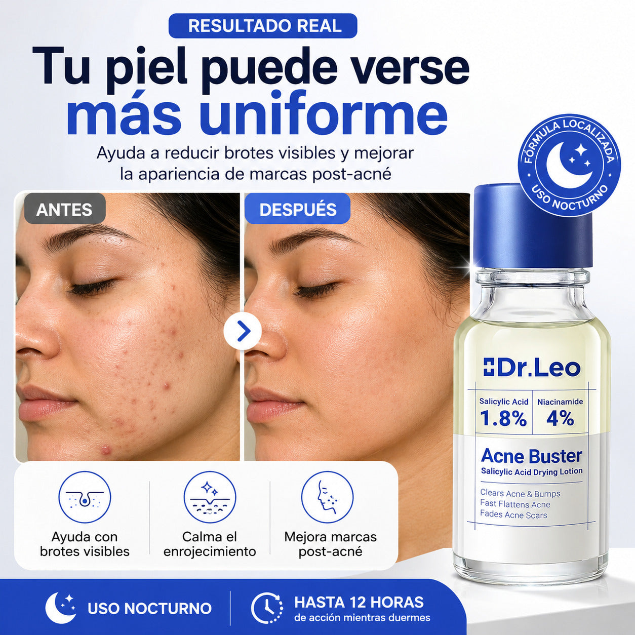 Reduce el grano en 24 horas. Aclara las marcas en 7 días.