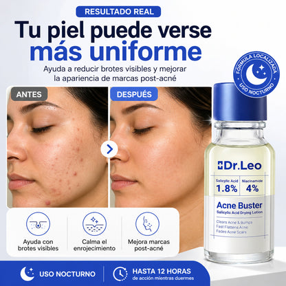 Reduce el grano en 24 horas. Aclara las marcas en 7 días.