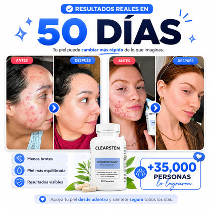 CLEARSTEM Mindbodyskin®  tu transformación de piel en 30 días, desde adentro
