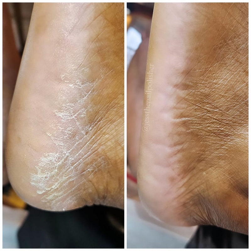 Problema: Irritación, manchas y piel maltratada